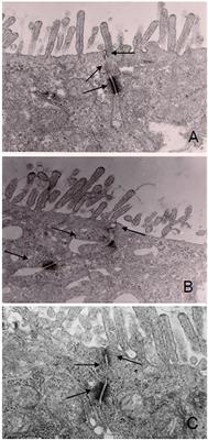 Ganglioside Alters Phospholipase Trafficking, Inhibits NF-κB Assembly, and Protects Tight Junction Integrity